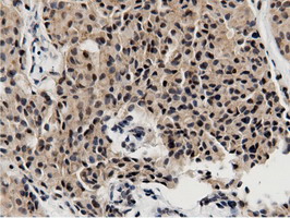 m11266 anti btn1a1 mouse monoclonal antibody clone id oti7b5 ihc testing 10
