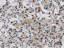 m11266 anti btn1a1 mouse monoclonal antibody clone id oti7b5 ihc testing 11