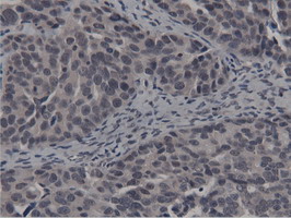 m11266 anti btn1a1 mouse monoclonal antibody clone id oti7b5 ihc testing 4