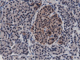 m11266 anti btn1a1 mouse monoclonal antibody clone id oti7b5 ihc testing 5