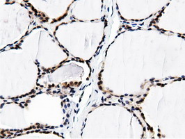 m11266 anti btn1a1 mouse monoclonal antibody clone id oti7b5 ihc testing 6