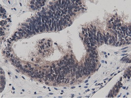 m11266 anti btn1a1 mouse monoclonal antibody clone id oti7b5 ihc testing 7