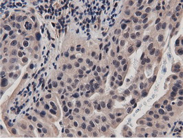 m11266 anti btn1a1 mouse monoclonal antibody clone id oti7b5 ihc testing 9