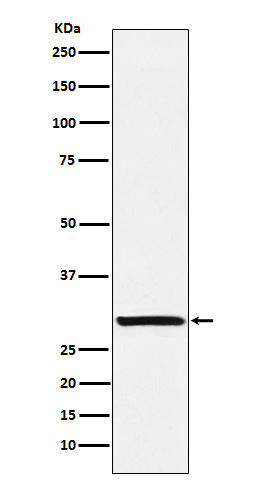 Western blot analysis of Intra Acrosomal Protein expression in Human testis lysate.
