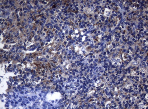 Immunohistochemical staining of paraffin-embedded Human lymph node tissue within the normal limits using anti-PITPNB mouse monoclonal antibody