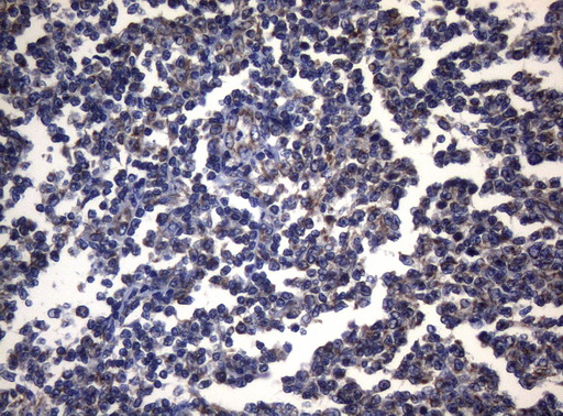 m11315 anti pitpnb mouse monoclonal antibody clone id oti6h10 ihc testing 4
