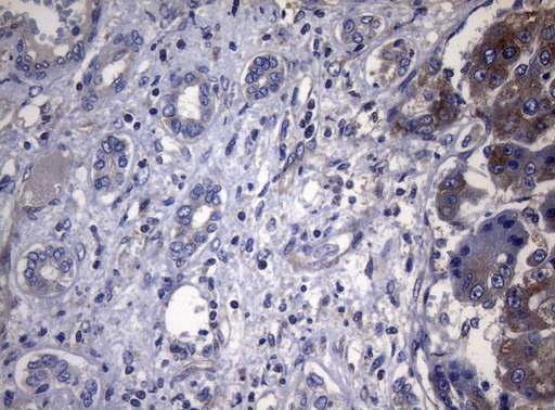 m11315 anti pitpnb mouse monoclonal antibody clone id oti6h10 ihc testing 6