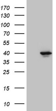HEK293T cells were transfected with the pCMV6-ENTRY control (Left lane) or pCMV6-ENTRY PITPNB (Right lane) cDNA for 48 hrs and lysed