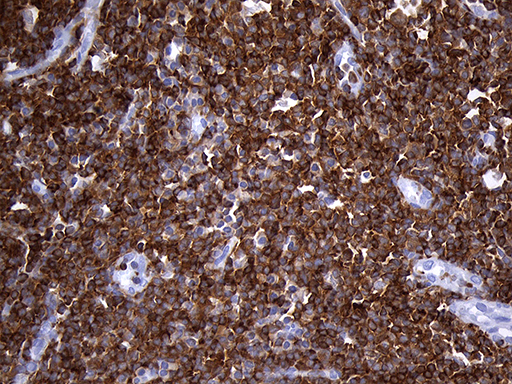 m11321 anti sh3bp1 mouse monoclonal antibody clone id oti1c9 ihc testing 10