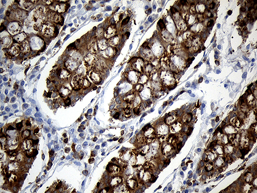 m11321 anti sh3bp1 mouse monoclonal antibody clone id oti1c9 ihc testing 11