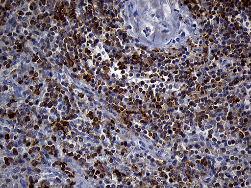 m11321 anti sh3bp1 mouse monoclonal antibody clone id oti1c9 ihc testing 12
