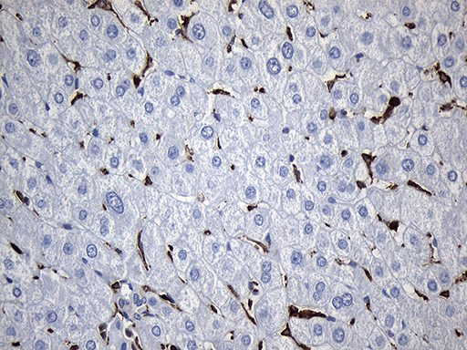 m11321 anti sh3bp1 mouse monoclonal antibody clone id oti1c9 ihc testing 13