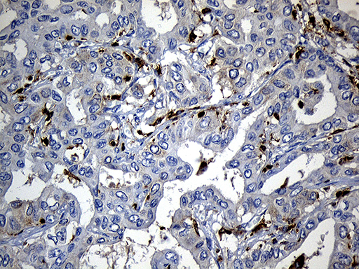 m11321 anti sh3bp1 mouse monoclonal antibody clone id oti1c9 ihc testing 14