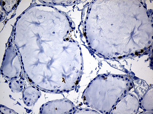 m11321 anti sh3bp1 mouse monoclonal antibody clone id oti1c9 ihc testing 3