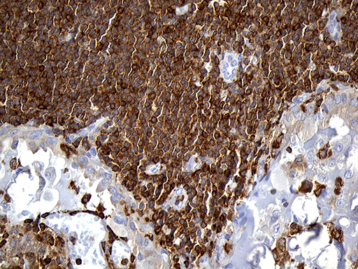 m11321 anti sh3bp1 mouse monoclonal antibody clone id oti1c9 ihc testing 4