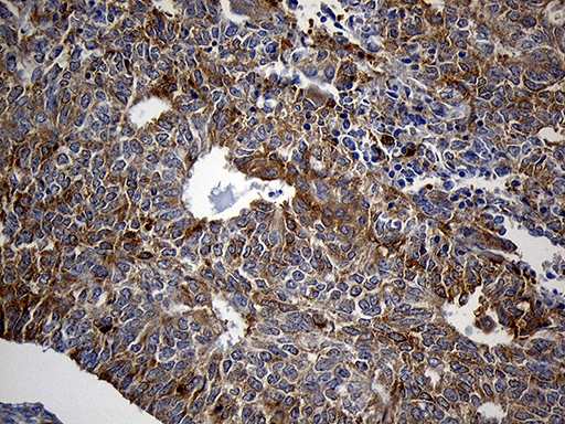 m11321 anti sh3bp1 mouse monoclonal antibody clone id oti1c9 ihc testing 6