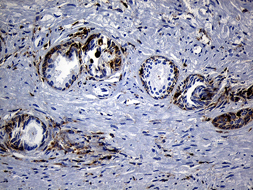 m11321 anti sh3bp1 mouse monoclonal antibody clone id oti1c9 ihc testing 7