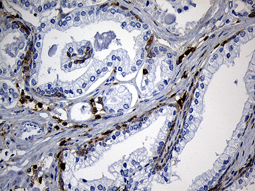 m11321 anti sh3bp1 mouse monoclonal antibody clone id oti1c9 ihc testing 8