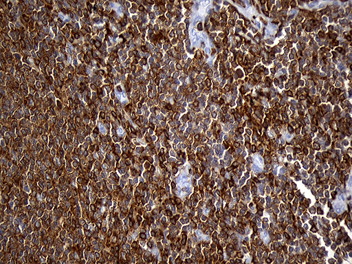 m11321 anti sh3bp1 mouse monoclonal antibody clone id oti1c9 ihc testing 9
