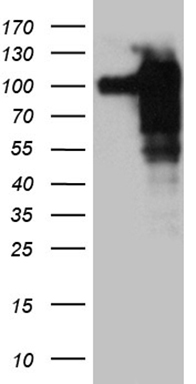 m11321 anti sh3bp1 mouse monoclonal antibody clone id oti1c9 wb testing 1