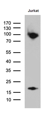 m11321 anti sh3bp1 mouse monoclonal antibody clone id oti1c9 wb testing 2