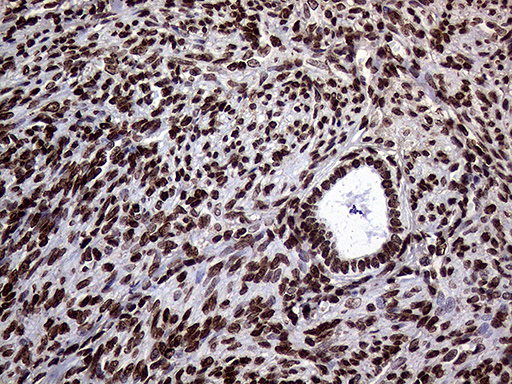 Immunohistochemical staining of paraffin-embedded Human endometrium tissue within the normal limits using anti-TRMT5 mouse monoclonal antibody