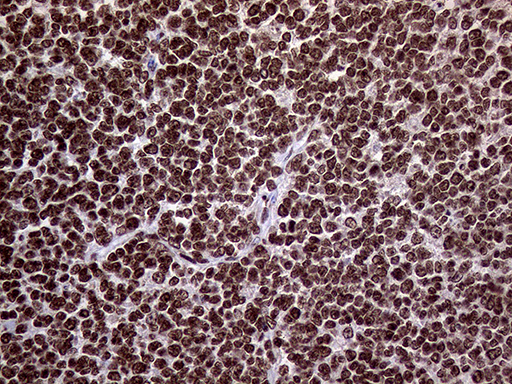m11359 anti trmt5 mouse monoclonal antibody clone id oti1b5 ihc testing 4