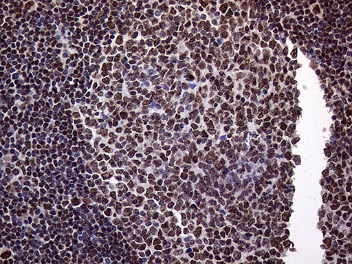 m11359 anti trmt5 mouse monoclonal antibody clone id oti1b5 ihc testing 5