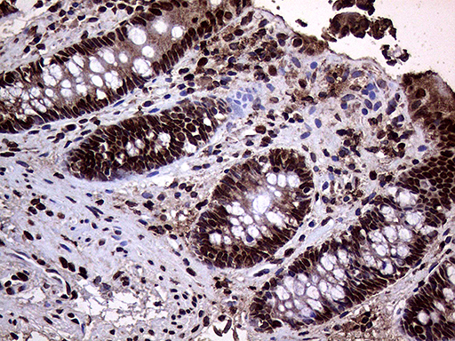 m11359 anti trmt5 mouse monoclonal antibody clone id oti1b5 ihc testing 6