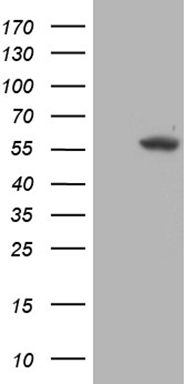 HEK293T cells were transfected with the pCMV6-ENTRY control (Left lane) or pCMV6-ENTRY TRMT5 (Right lane) cDNA for 48 hrs and lysed