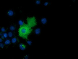m11378 anti adenylate kinase 5 ak5 mouse monoclonal antibody clone id oti2f9 if testing 23