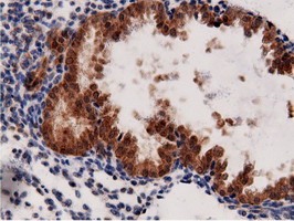 m11378 anti adenylate kinase 5 ak5 mouse monoclonal antibody clone id oti2f9 ihc testing 10