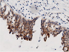 m11378 anti adenylate kinase 5 ak5 mouse monoclonal antibody clone id oti2f9 ihc testing 11