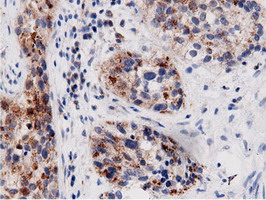 m11378 anti adenylate kinase 5 ak5 mouse monoclonal antibody clone id oti2f9 ihc testing 12