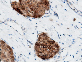 m11378 anti adenylate kinase 5 ak5 mouse monoclonal antibody clone id oti2f9 ihc testing 13