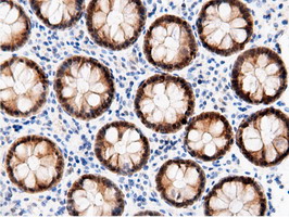 m11378 anti adenylate kinase 5 ak5 mouse monoclonal antibody clone id oti2f9 ihc testing 14