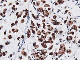 m11378 anti adenylate kinase 5 ak5 mouse monoclonal antibody clone id oti2f9 ihc testing 15