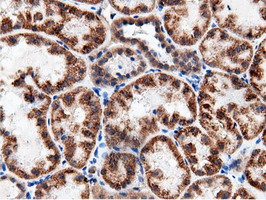 m11378 anti adenylate kinase 5 ak5 mouse monoclonal antibody clone id oti2f9 ihc testing 16