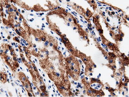 m11378 anti adenylate kinase 5 ak5 mouse monoclonal antibody clone id oti2f9 ihc testing 17