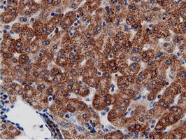 m11378 anti adenylate kinase 5 ak5 mouse monoclonal antibody clone id oti2f9 ihc testing 18
