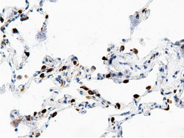 m11378 anti adenylate kinase 5 ak5 mouse monoclonal antibody clone id oti2f9 ihc testing 19