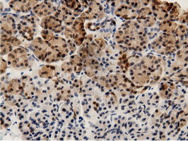 m11378 anti adenylate kinase 5 ak5 mouse monoclonal antibody clone id oti2f9 ihc testing 4