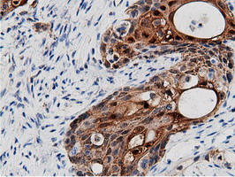 m11378 anti adenylate kinase 5 ak5 mouse monoclonal antibody clone id oti2f9 ihc testing 5