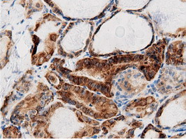 m11378 anti adenylate kinase 5 ak5 mouse monoclonal antibody clone id oti2f9 ihc testing 6