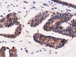 m11378 anti adenylate kinase 5 ak5 mouse monoclonal antibody clone id oti2f9 ihc testing 7