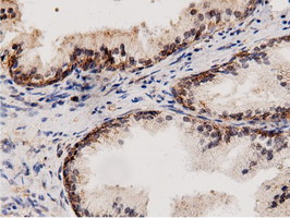 m11378 anti adenylate kinase 5 ak5 mouse monoclonal antibody clone id oti2f9 ihc testing 8
