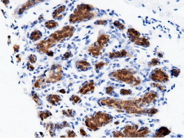m11378 anti adenylate kinase 5 ak5 mouse monoclonal antibody clone id oti2f9 ihc testing 9