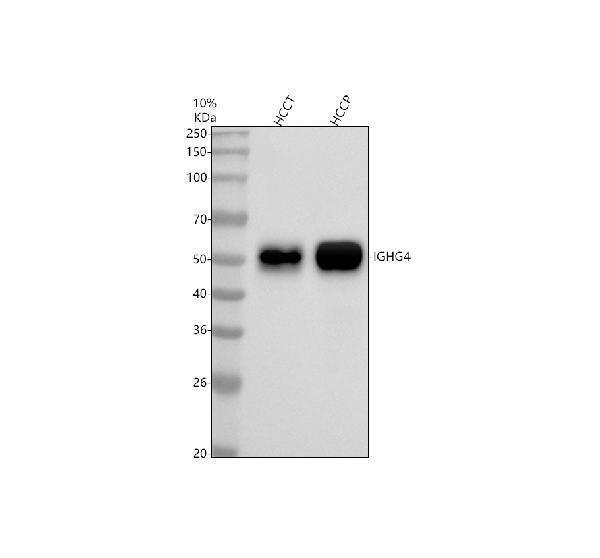 Western blot analysis of IGHG4 using anti-IGHG4 antibody (M11385-1)