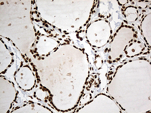 m11406 anti irf2bp1 mouse monoclonal antibody clone id oti3a6 ihc testing 2
