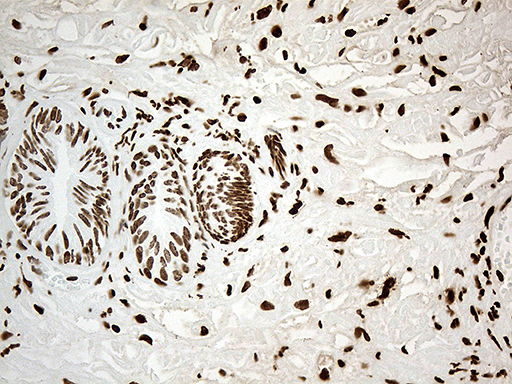 m11406 anti irf2bp1 mouse monoclonal antibody clone id oti3a6 ihc testing 3